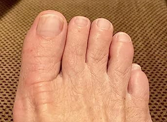 Unghia del piede rosa, pulita e sana: il dopo